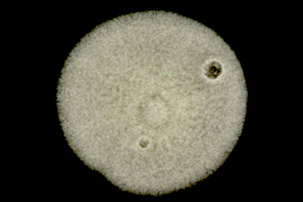 Foto eines Keims, mikroskopische Aufnahme